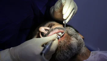 وزیر بهداشت جمهوری اسلامی نسبت به وضعیت بحرانی سلامت دهان در کشور هشدار داد و اعلام کرد که ۵۵ درصد از سالمندان بالای ۶۵ سال در ایران کاملاً بیدندان هستند؛ رقمی که دو برابر میانگین جهانی است.