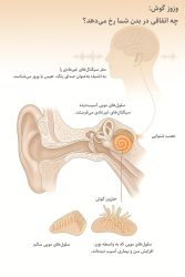 وزوز گوش جزو بیماریها نیست، بلکه از وجود یک مشکل زمینهای حکایت دارد. راهکارهای درمانی طبی و فناورانه مختلفی برای این عارضه وجود دارد...