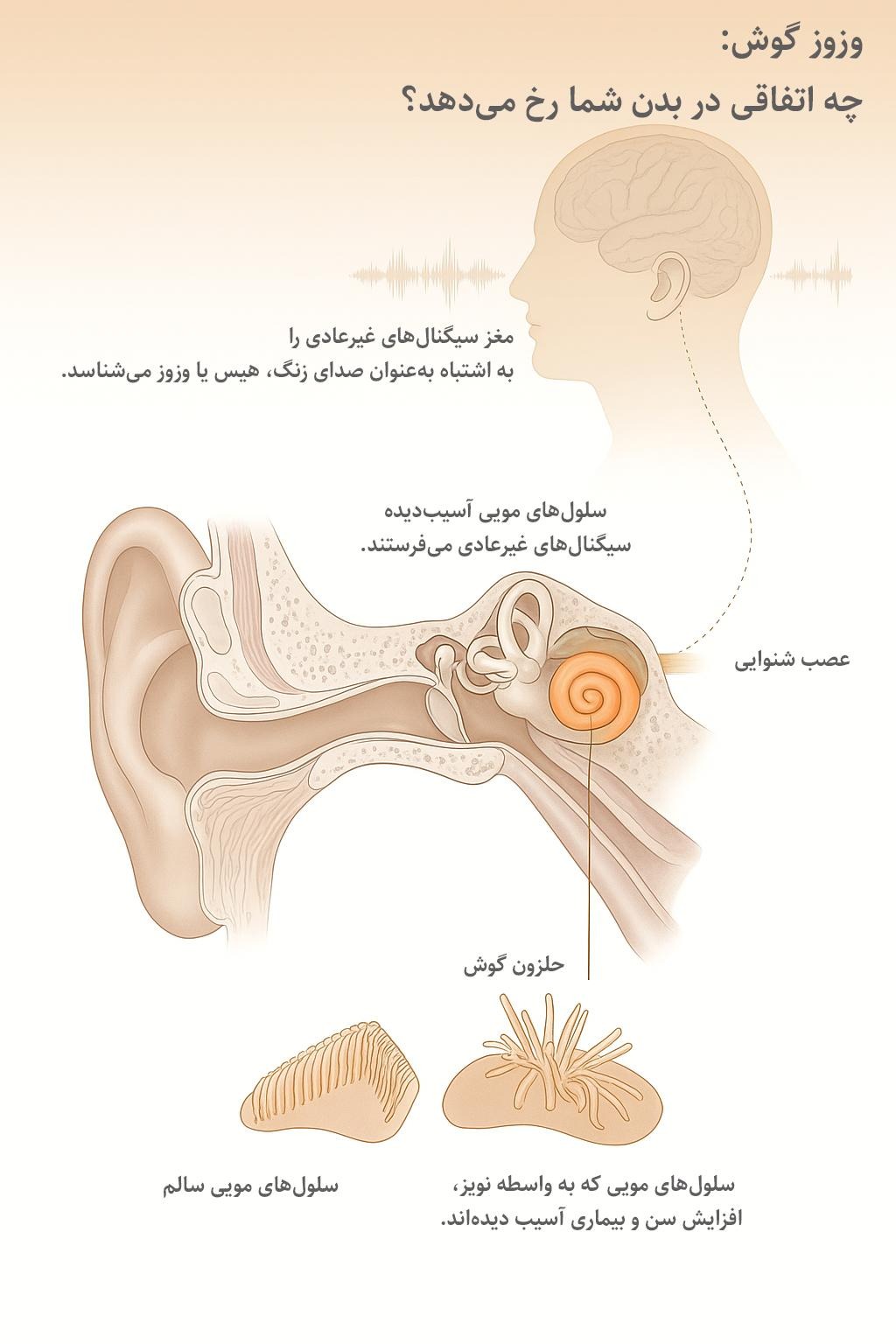 وزوز گوش جزو بیماریها نیست، بلکه از وجود یک مشکل زمینهای حکایت دارد. راهکارهای درمانی طبی و فناورانه مختلفی برای این عارضه وجود دارد...
