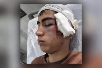 در پی ضربوشتم یک دانشآموز در یکی از دبیرستانهای شهرستان بم و مصدومیت شدید او از ناحیه سر و صورت، اداره آموزش و پرورش این شهرستان از بررسی و معرفی متخلفان خبر داد.