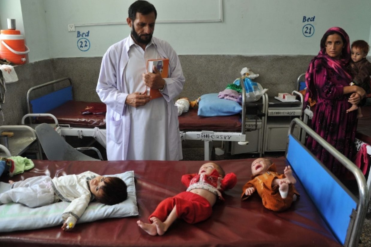 ۴۰.۹ درصد از کودکان در افغانستان دچار سوء تغذیه‌‏ی هستند. (Noorullah Shirzada/AFP/Getty Images)