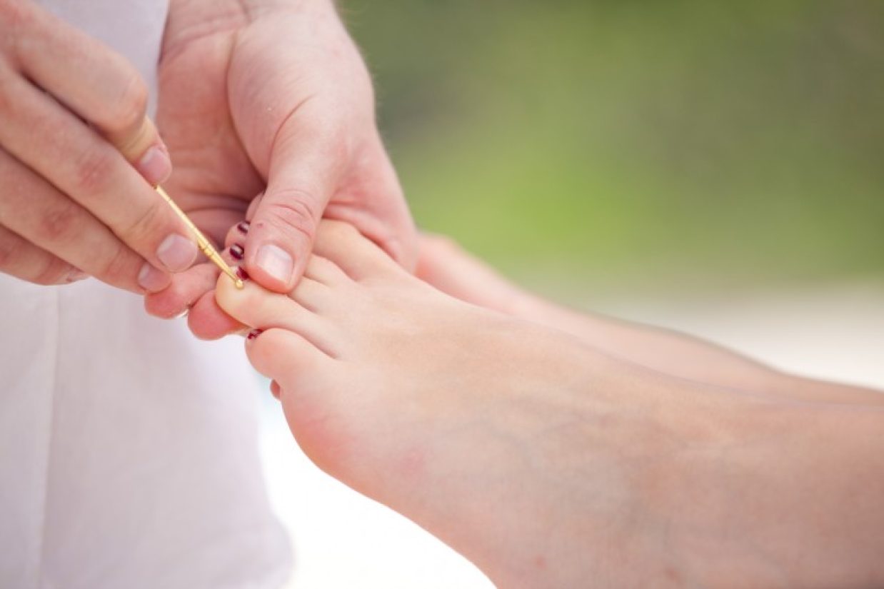 طب چینی براین باور است که برای سلامت بدن حفظ تعادل میان یین ویانگ ضروری می‌‏باشد. آنها  بالای بدن را یانگ و پائین بدن را یین می‌‏پندارند که به وسیله کانالهای انرژی به یکدیگر متصل می‌‏باشند. برهمین اساس، یکی از راه‌‏های تسکین درد گردن وشانه، درمان روی پا می باشد(وُلفانگ اَمری/ Photos.com) .