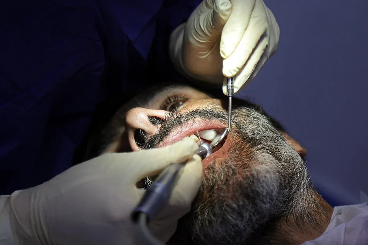 وزیر بهداشت جمهوری اسلامی نسبت به وضعیت بحرانی سلامت دهان در کشور هشدار داد و اعلام کرد که ۵۵ درصد از سالمندان بالای ۶۵ سال در ایران کاملاً بی‌دندان هستند؛ رقمی که دو برابر میانگین جهانی است.