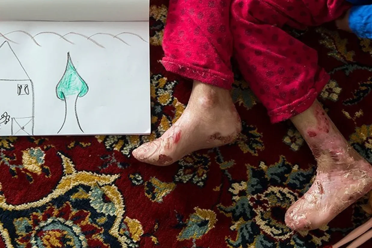 حمیدرضا ادراکی، مدیرعامل بنیاد بیماری‌های نادر ایران، در گفت‌وگو با ایلنا گفت که به دلیل «مقرون به صرفه نبودن»، داروهای بیماری‌های نادر توسط شرکت‌های داخلی تولید نمی‌شوند و برای واردات آن‌ها ابتدا باید ارز تأمین شود. او ترخیص نشدن دارو از گمرک را «غیرقابل توجیه» دانست و تأکید کرد که داروها نباید در گمرک بمانند و تاریخ مصرفشان بگذرد بلکه باید سریعاً به دست بیماران برسند تا وقفه‌ای در درمان ایجاد نشود.