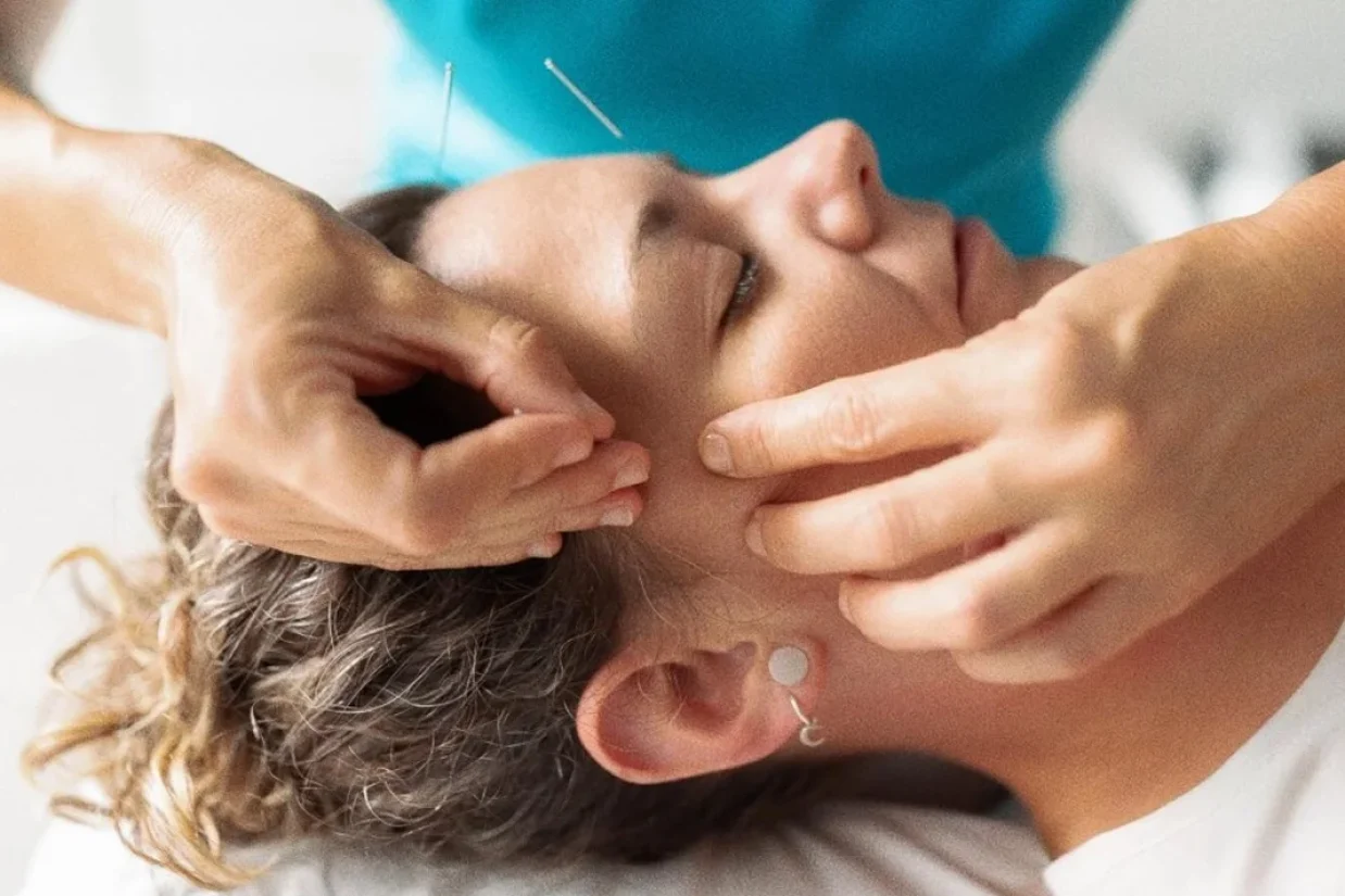 نقش طب سوزنی صورت در جوان‌سازی پوست؛ کاهش چین‌وچروک، بهبود رنگ چهره و تقویت سلامت درونی براساس طب سنتی چینی.
