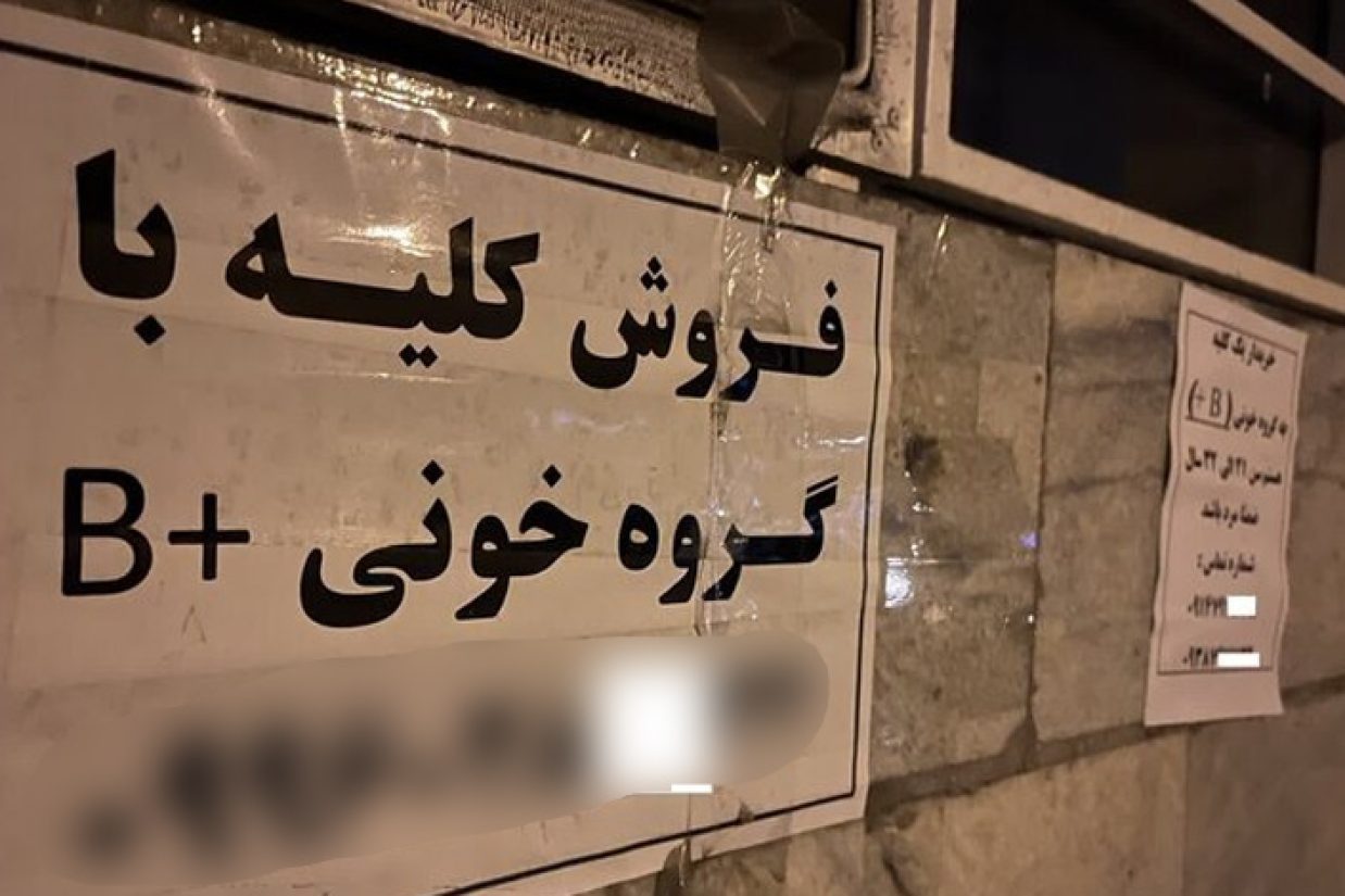 طرح ایجاد بازار فروش کلیه انسان باعث می‌شود اقشار ضعیف و آسیب‌پذیر به چشم منابعی آماده برای استثمارگری دیده ‌شوند.