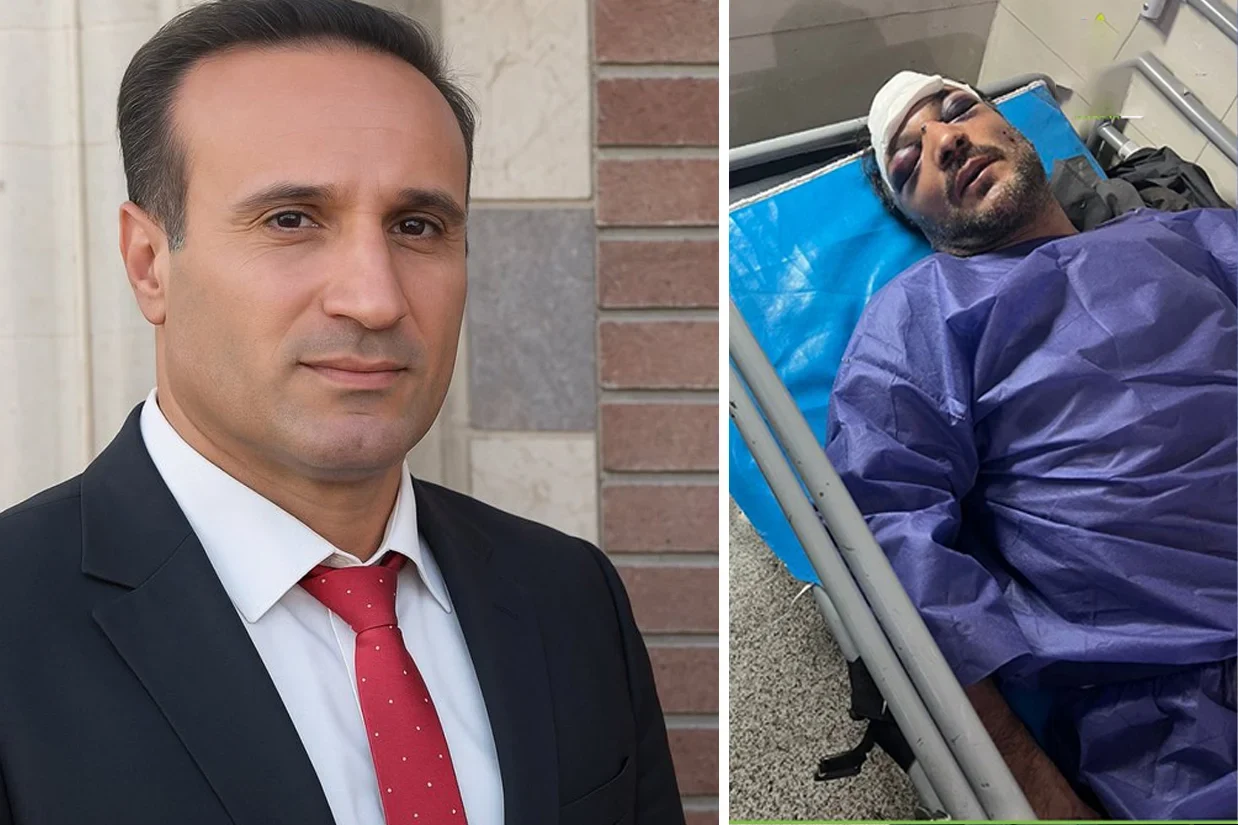 دادبان گزارش داد محمدرضا مرادبهروزی، زندانی سیاسی محبوس در زندان چوبیندر قزوین، شامگاه گذشته در این زندان به‌شدت مورد ضرب‌وشتم قرار گرفته و در پی شدت جراحات به بیمارستان منتقل شده است.